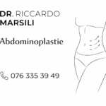 Tout savoir sur l&rsquo;abdominoplastie