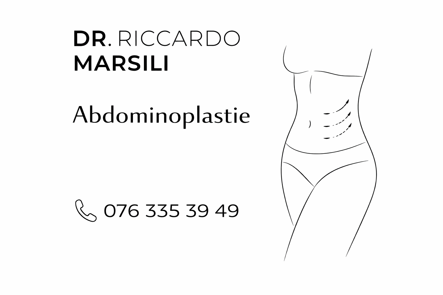 Tout savoir sur l&rsquo;abdominoplastie