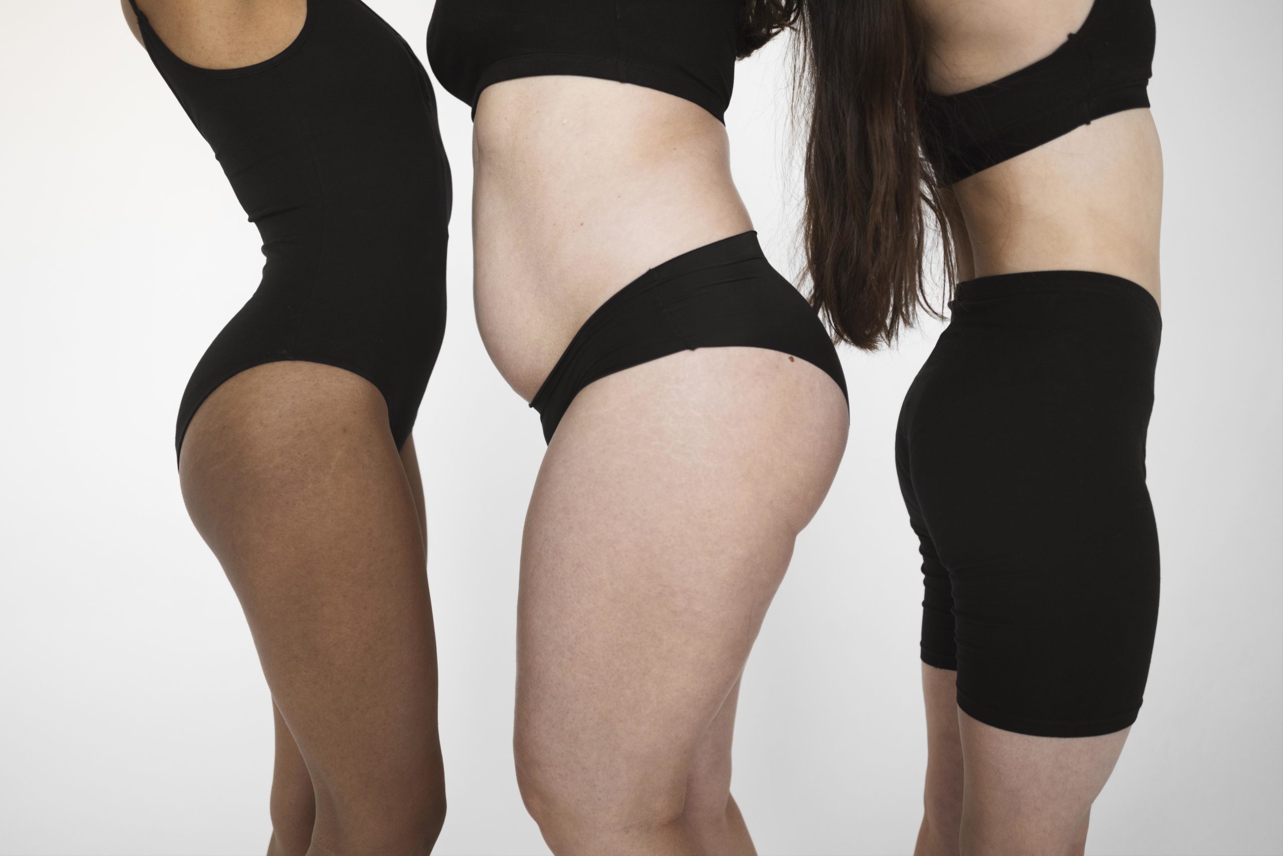 Pourquoi les femmes font une liposuccion à Lausanne ?