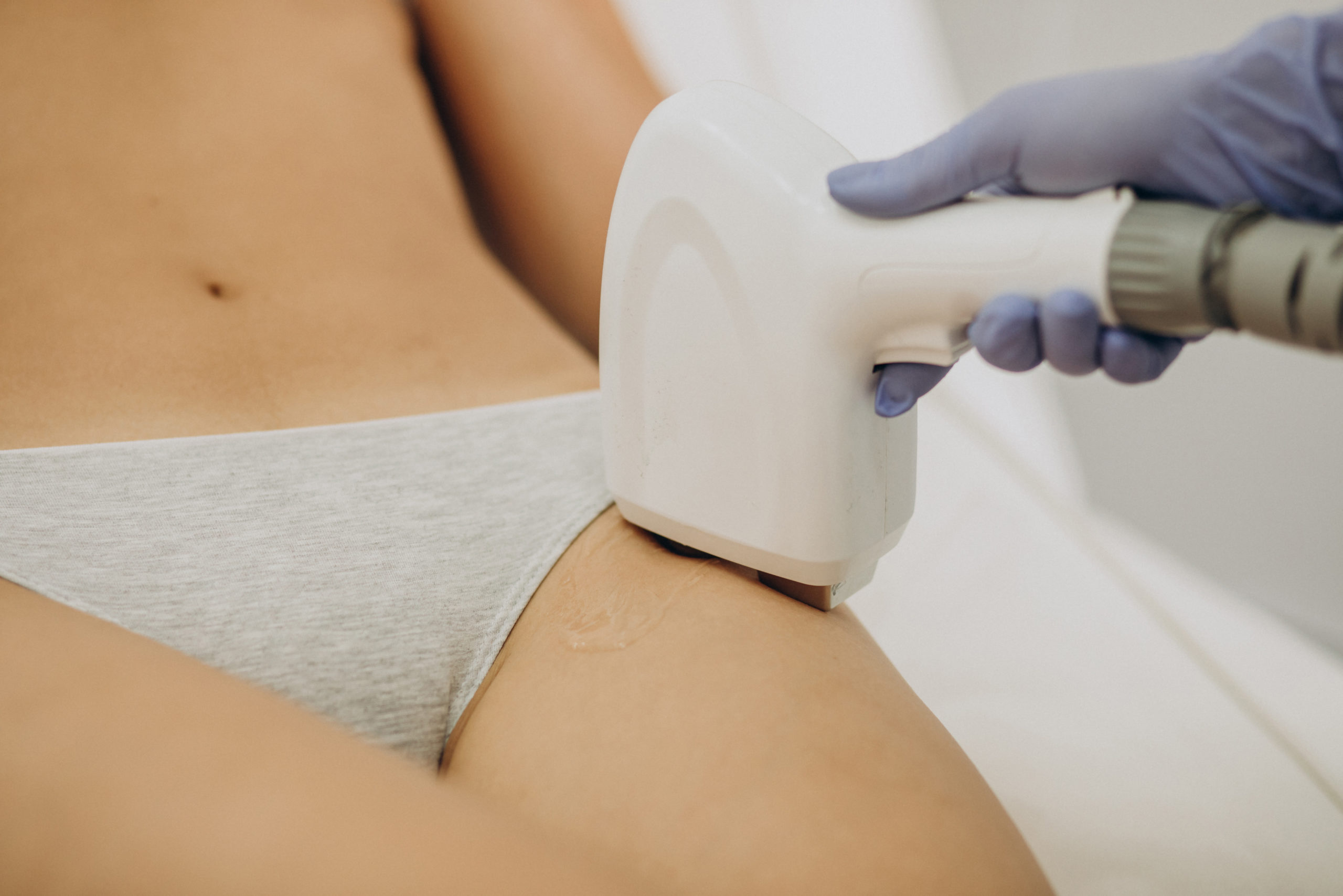 Questions importantes épilation laser en Suisse