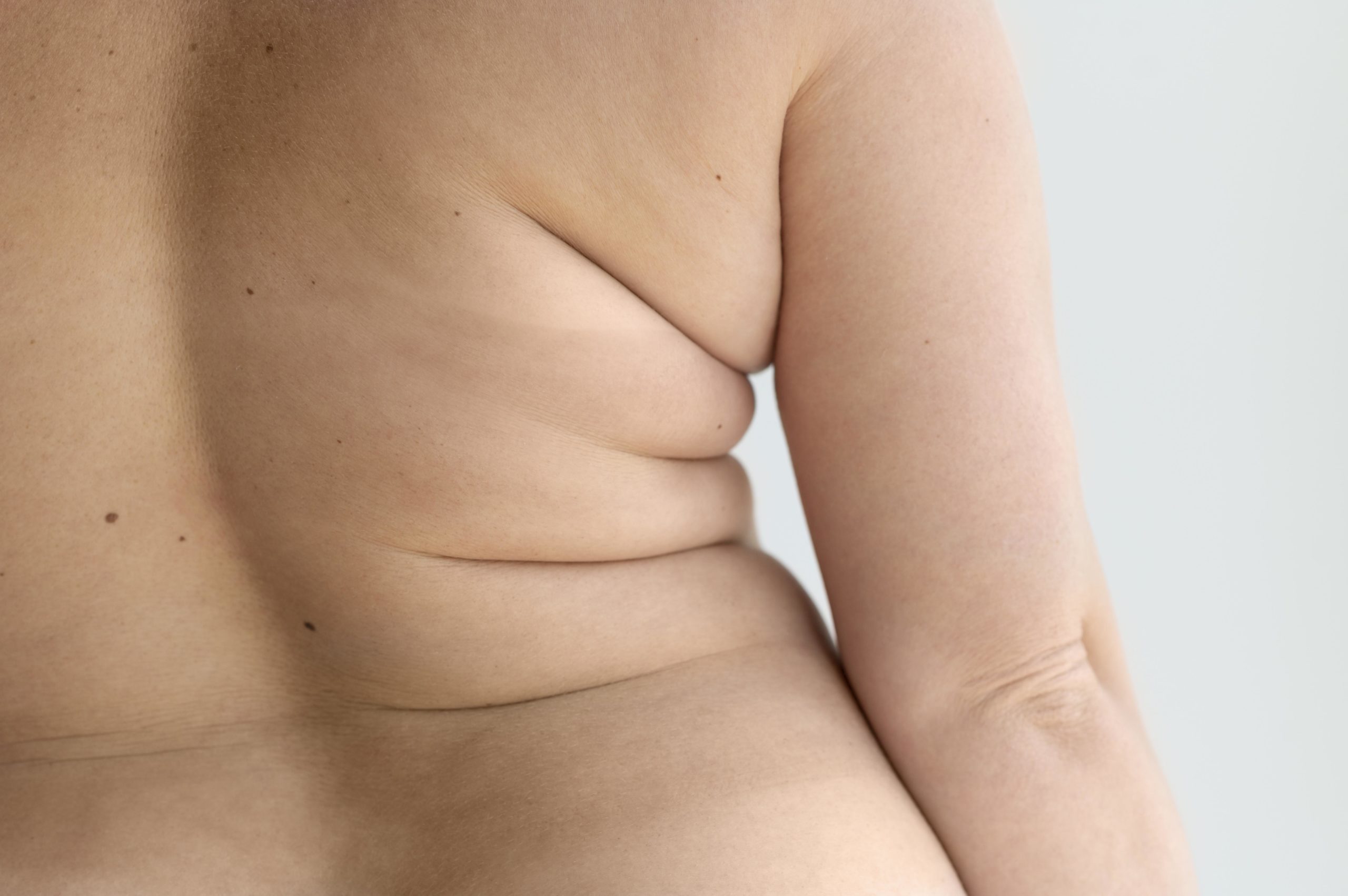 Des questions sur la liposuccion en Suisse